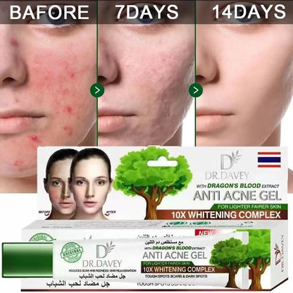 dr-davey-dragon-s-blood-anti-acne-gel-30g-pinoyhyper-1